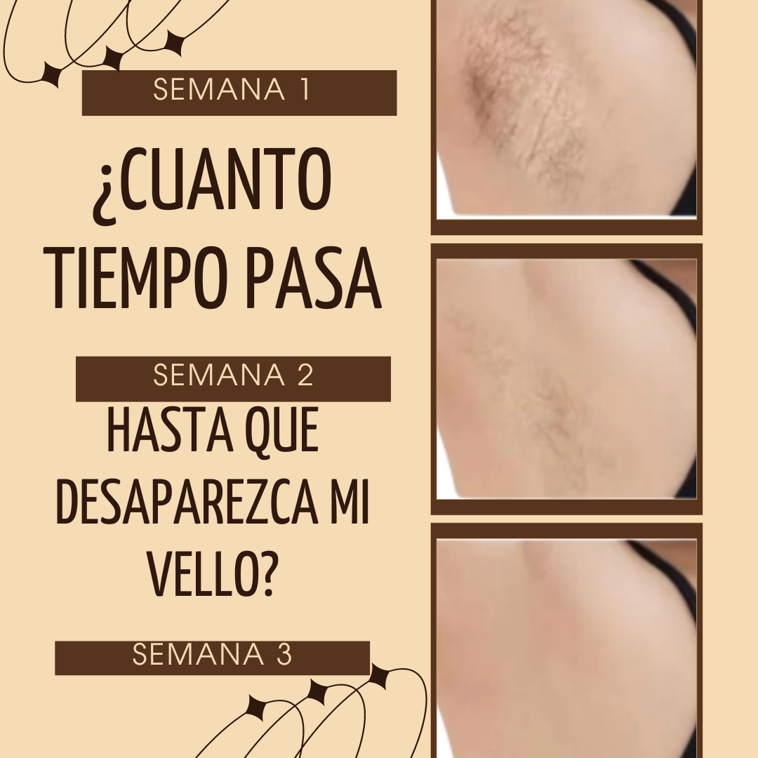 Clean Skin™️ DEPILADORA LASER IPL